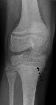 ������: �������� PoisoningRadio.jpg